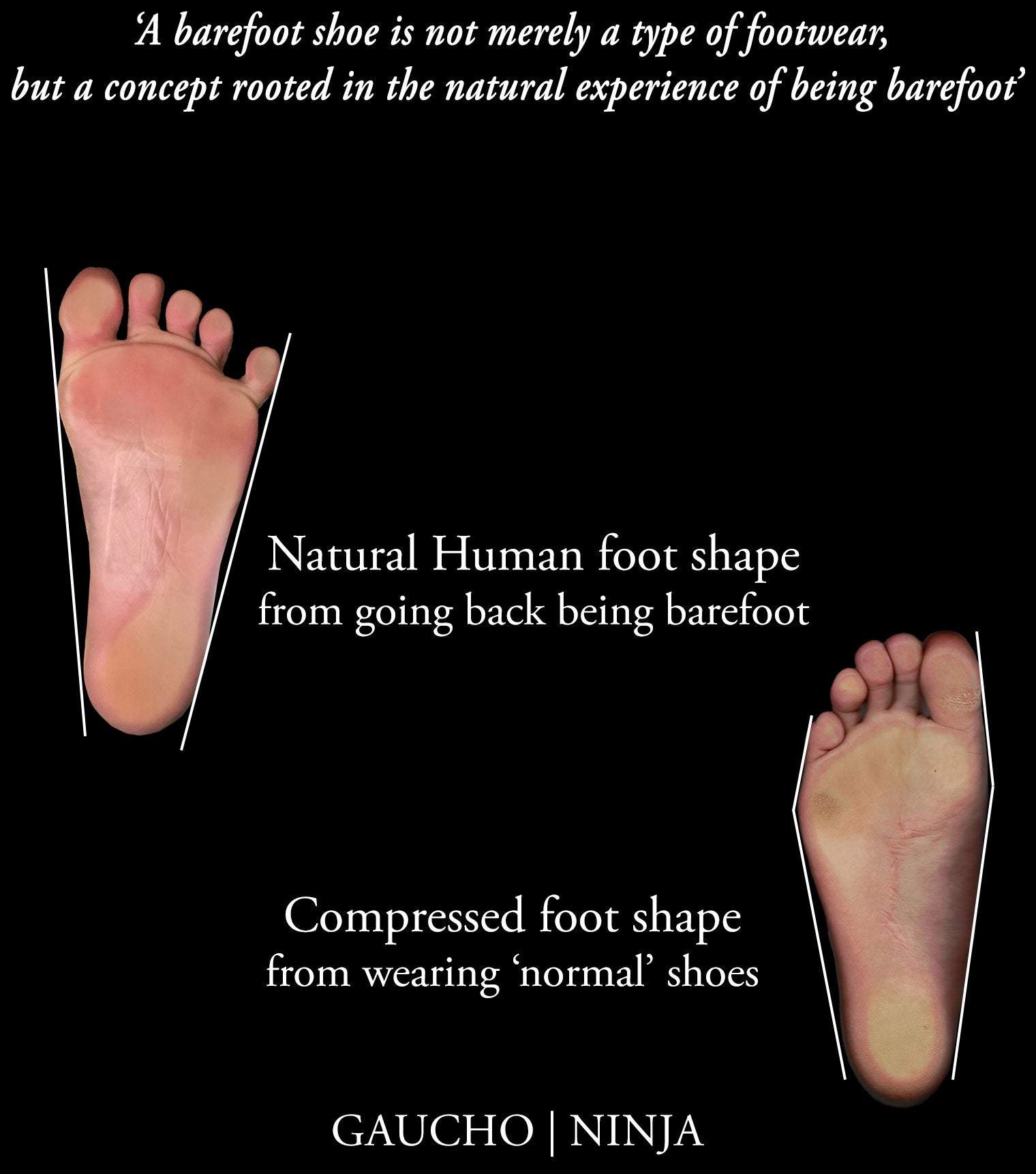 Are All Barefoot Shoes Truly Barefoot, and Are They All Sustainable?